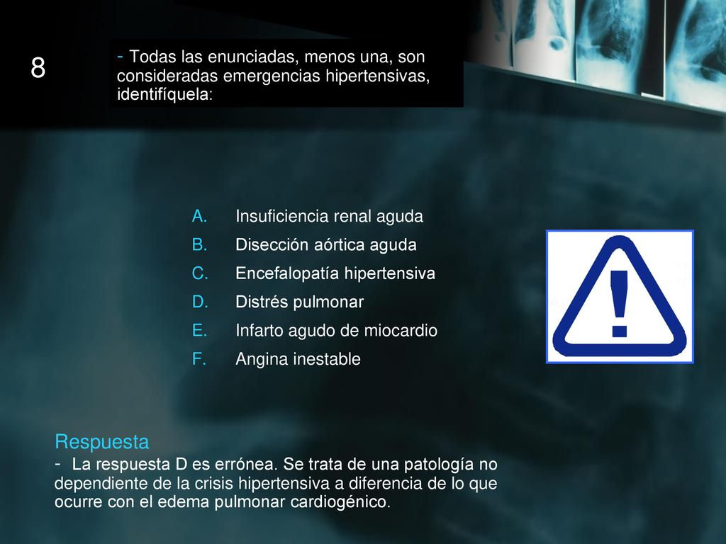 - Todas las enunciadas, menos una, son consideradas emergencias hipertensivas, identifíquela: