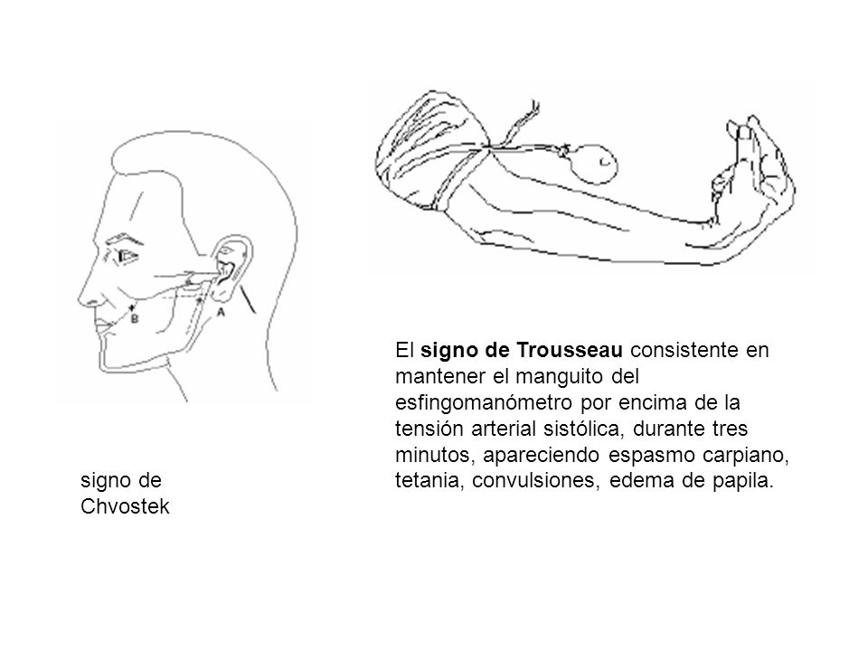 El signo de Trousseau consistente en mantener el manguito del esfingomanómetro por encima de la tensión arterial sistólica, durante tres minutos, apareciendo espasmo carpiano, tetania, convulsiones, edema de papila.