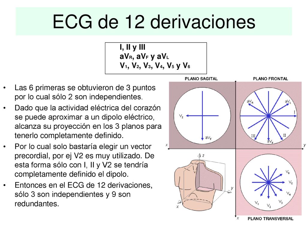 ECG de 12 derivaciones I, II y III aVR, aVF y aVL