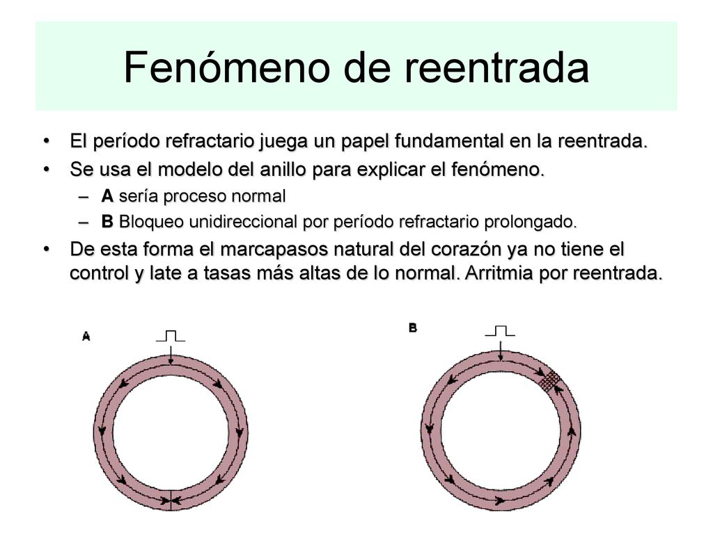 Fenómeno de reentrada El período refractario juega un papel fundamental en la reentrada. Se usa el modelo del anillo para explicar el fenómeno.