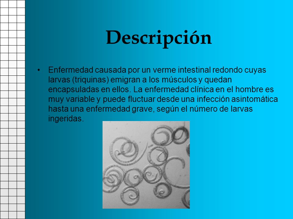 Descripción