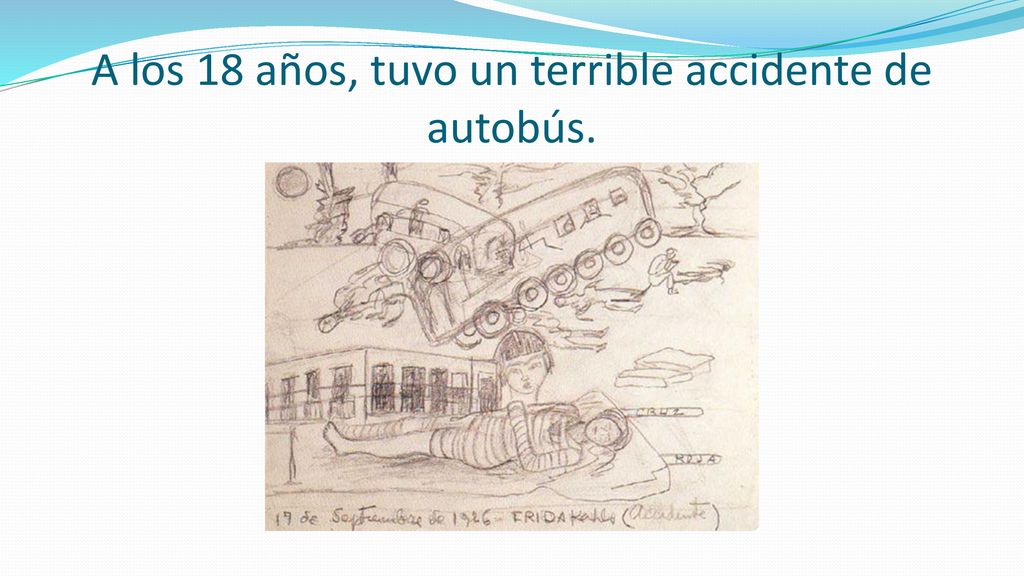 A los 18 años, tuvo un terrible accidente de autobús.