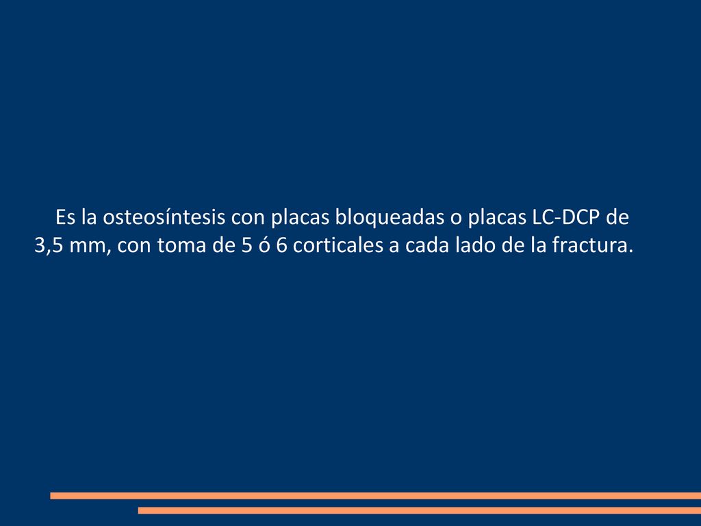 Es la osteosíntesis con placas bloqueadas o placas LC-DCP de 3,5 mm, con toma de 5 ó 6 corticales a cada lado de la fractura.