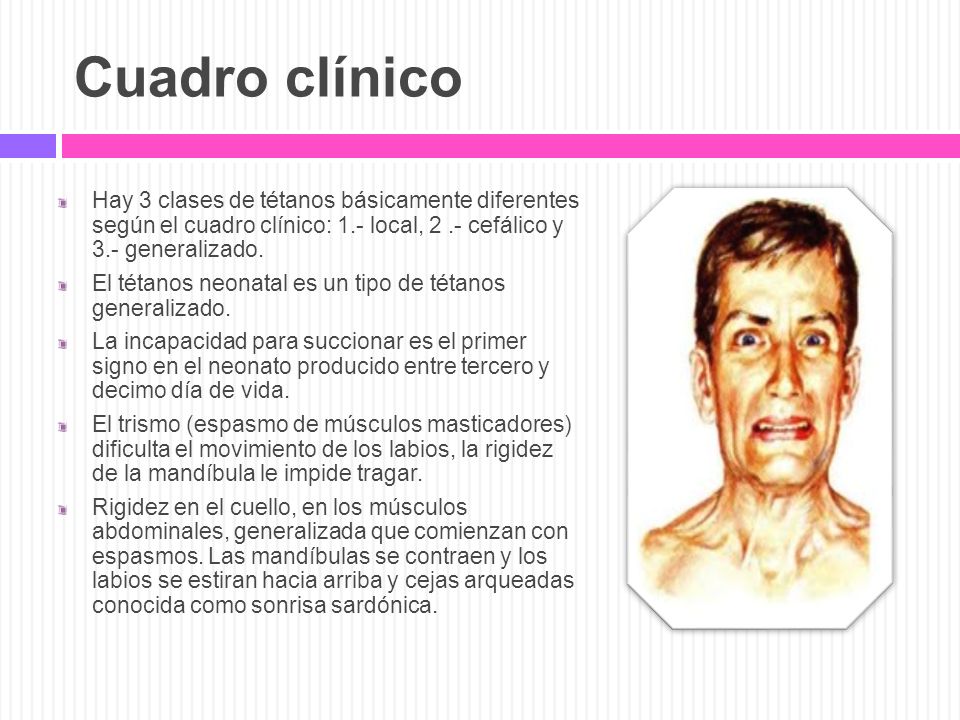Cuadro clínico Hay 3 clases de tétanos básicamente diferentes según el cuadro clínico: 1.- local, 2 .- cefálico y 3.- generalizado.