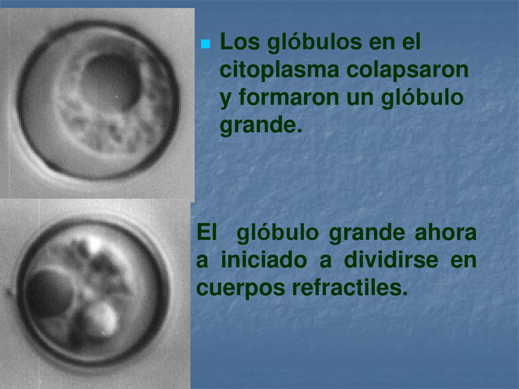 Los glóbulos en el citoplasma colapsaron y formaron un glóbulo grande.