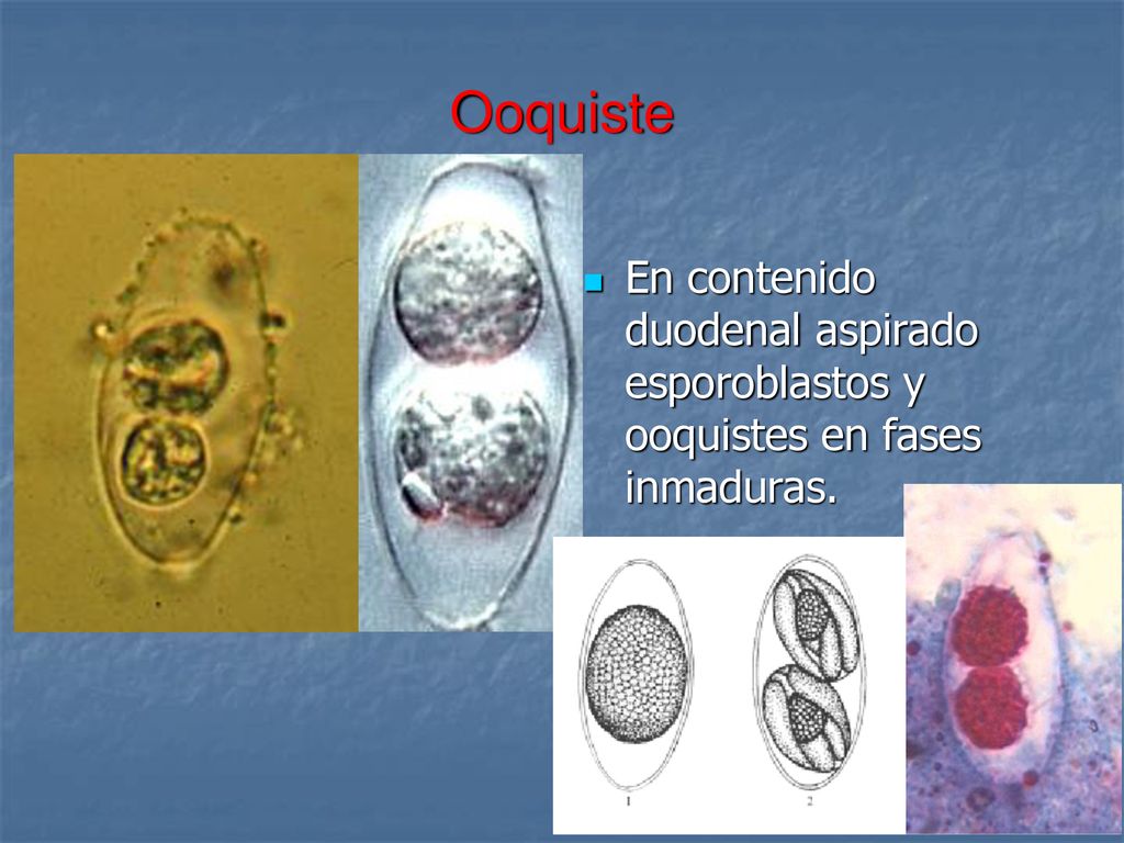 Ooquiste En contenido duodenal aspirado esporoblastos y ooquistes en fases inmaduras.