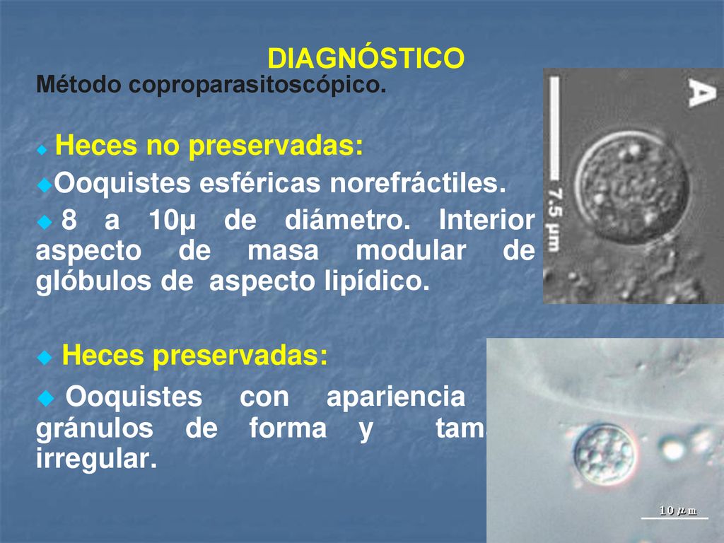 Ooquistes con apariencia de gránulos de forma y tamaño irregular.