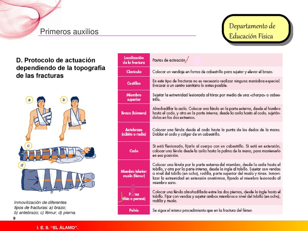D. Protocolo de actuación dependiendo de la topografía de las fracturas