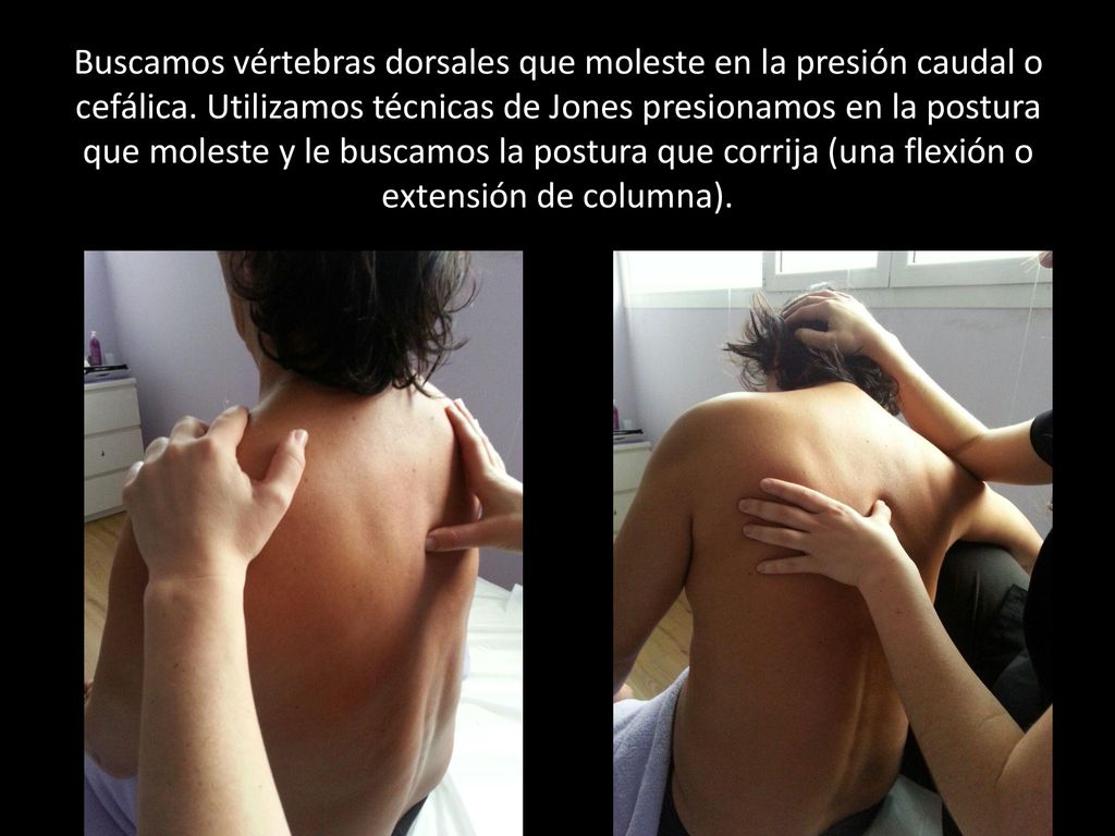 Buscamos vértebras dorsales que moleste en la presión caudal o cefálica.