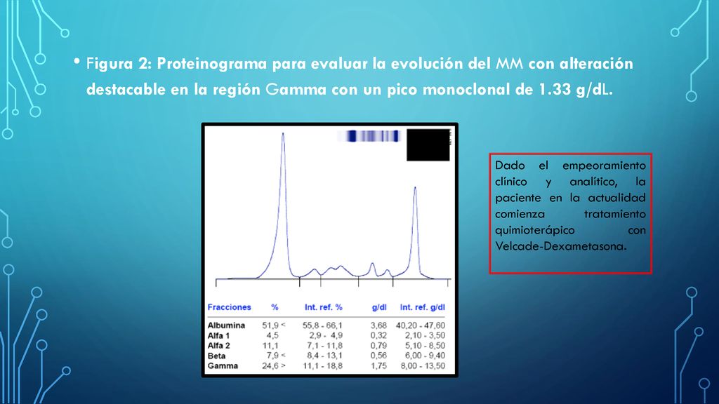 Figura 2: Proteinograma para evaluar la evolución del MM con alteración destacable en la región Gamma con un pico monoclonal de 1.33 g/dL.