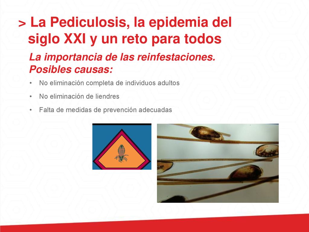 > La Pediculosis, la epidemia del siglo XXI y un reto para todos