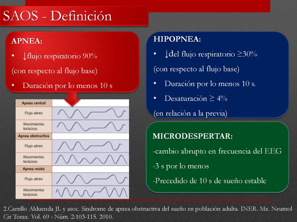 SAOS - Definición HIPOPNEA: APNEA: ↓del flujo respiratorio ≥30%