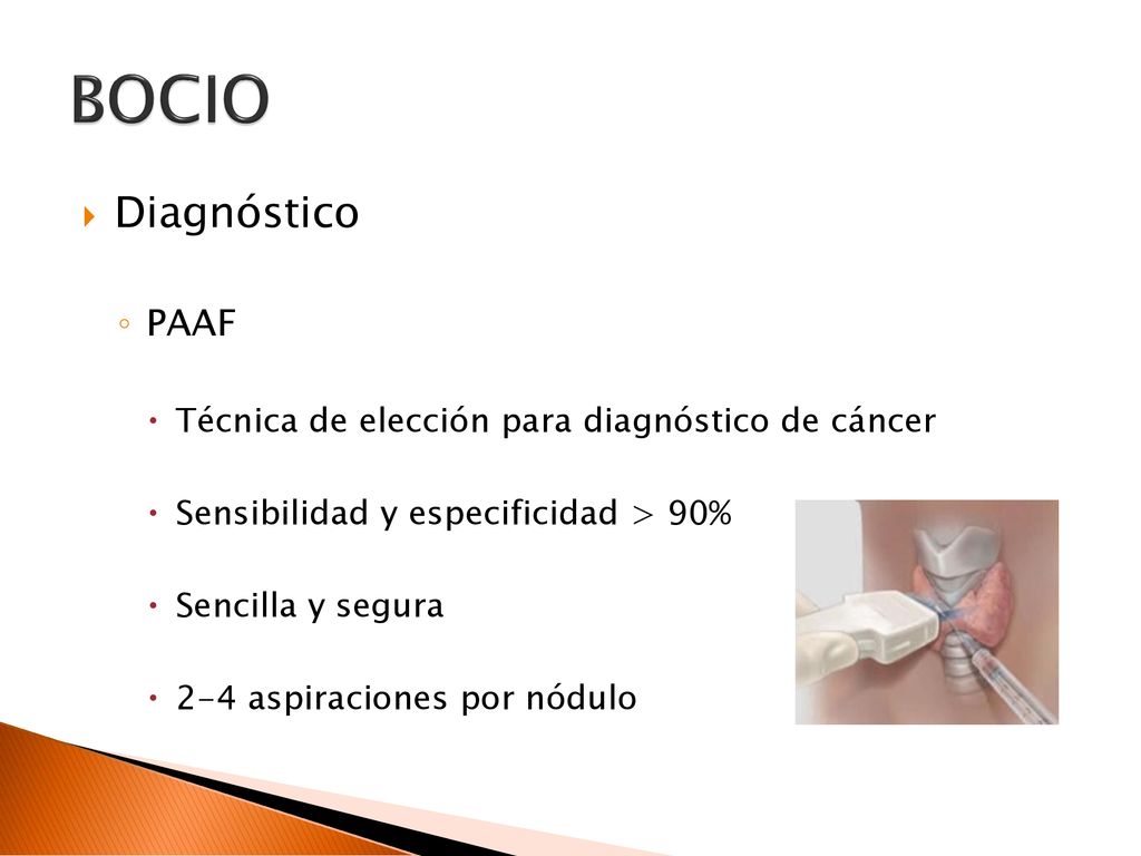 BOCIO Diagnóstico PAAF Técnica de elección para diagnóstico de cáncer