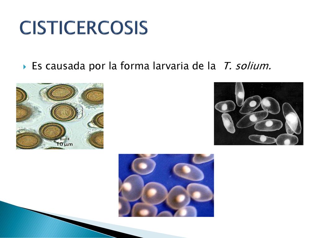 CISTICERCOSIS Es causada por la forma larvaria de la T. solium.
