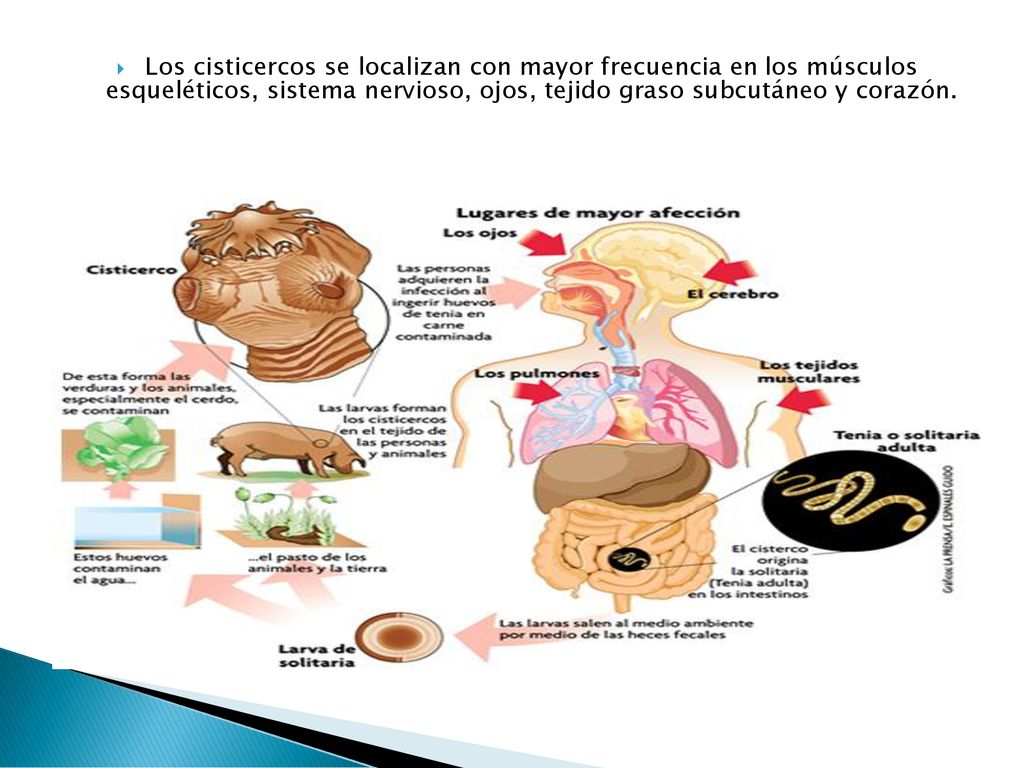 Los cisticercos se localizan con mayor frecuencia en los músculos esqueléticos, sistema nervioso, ojos, tejido graso subcutáneo y corazón.