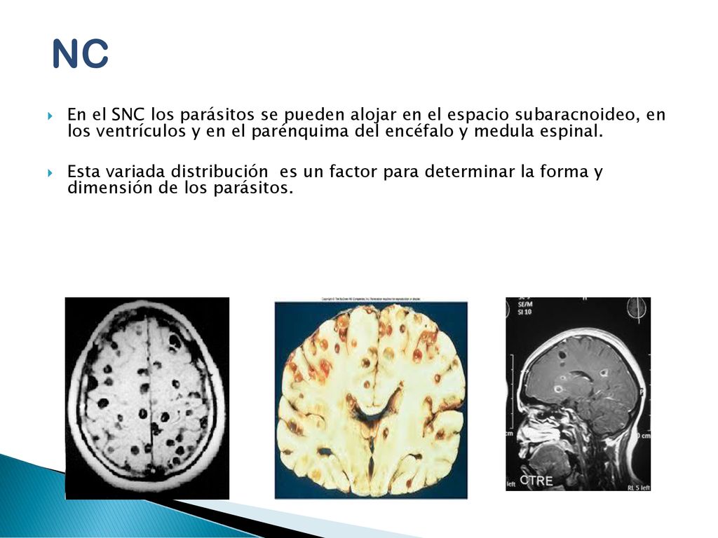 NC En el SNC los parásitos se pueden alojar en el espacio subaracnoideo, en los ventrículos y en el parénquima del encéfalo y medula espinal.