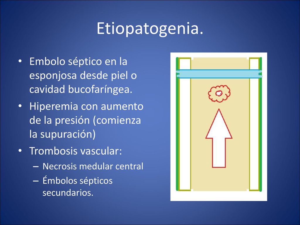 Etiopatogenia. Embolo séptico en la esponjosa desde piel o cavidad bucofaríngea. Hiperemia con aumento de la presión (comienza la supuración)