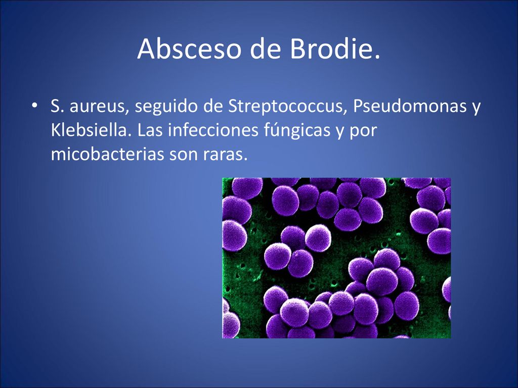 Absceso de Brodie. S. aureus, seguido de Streptococcus, Pseudomonas y Klebsiella.