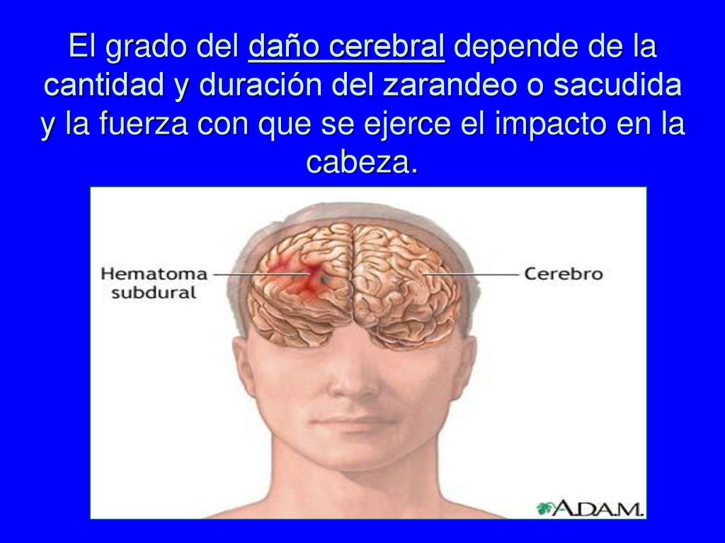 El grado del daño cerebral depende de la cantidad y duración del zarandeo o sacudida y la fuerza con que se ejerce el impacto en la cabeza.