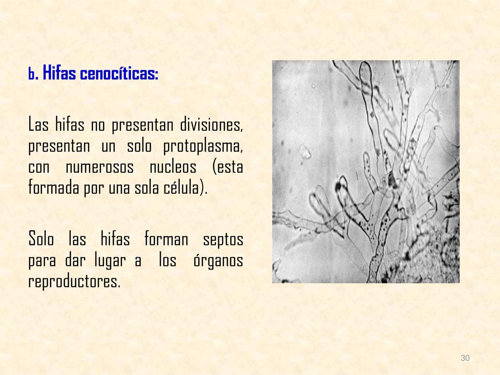 b. Hifas cenocíticas: Las hifas no presentan divisiones, presentan un solo protoplasma, con numerosos nucleos (esta formada por una sola célula).