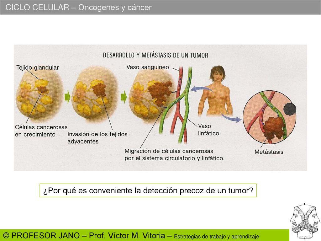 ¿Por qué es conveniente la detección precoz de un tumor