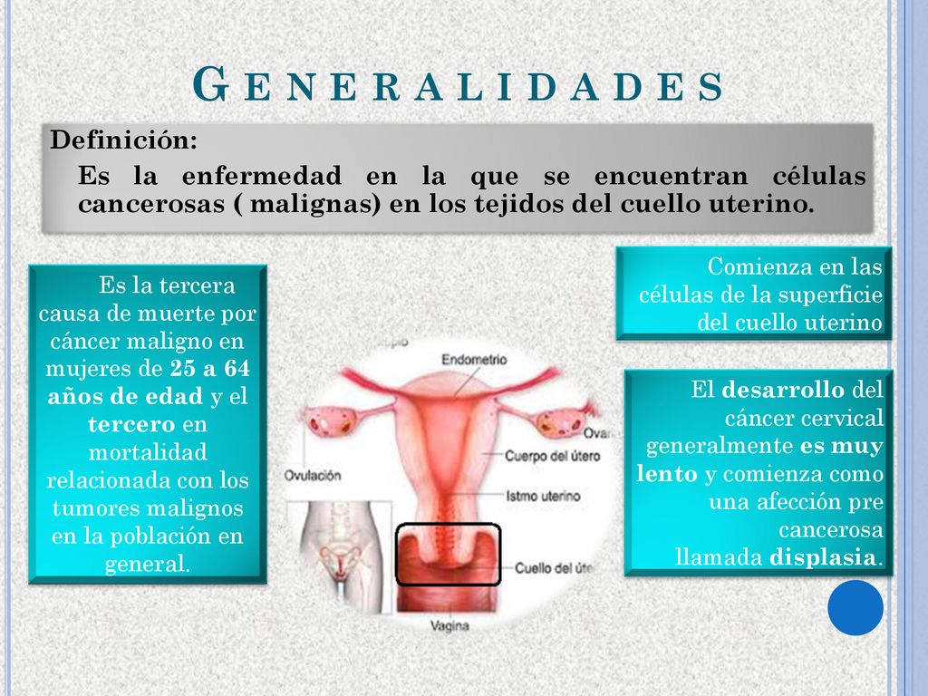 G e n e r a l i d a d e s Definición: Es la enfermedad en la que se encuentran células cancerosas ( malignas) en los tejidos del cuello uterino.