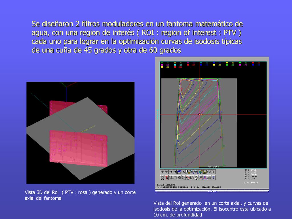 Se diseñaron 2 filtros moduladores en un fantoma matemático de agua, con una region de interés ( ROI : region of interest : PTV ) cada uno para lograr en la optimización curvas de isodosis típicas de una cuña de 45 grados y otra de 60 grados