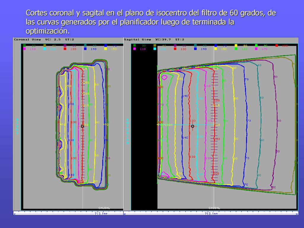 Cortes coronal y sagital en el plano de isocentro del filtro de 60 grados, de las curvas generados por el planificador luego de terminada la optimización.