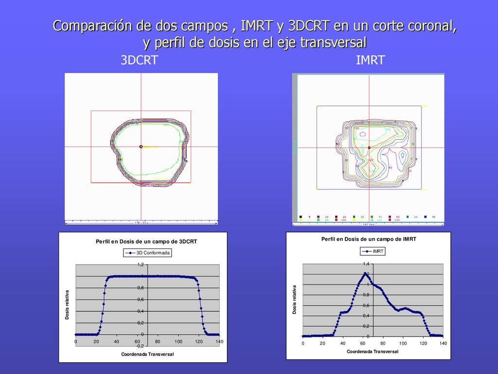 Comparación de dos campos , IMRT y 3DCRT en un corte coronal, y perfil de dosis en el eje transversal