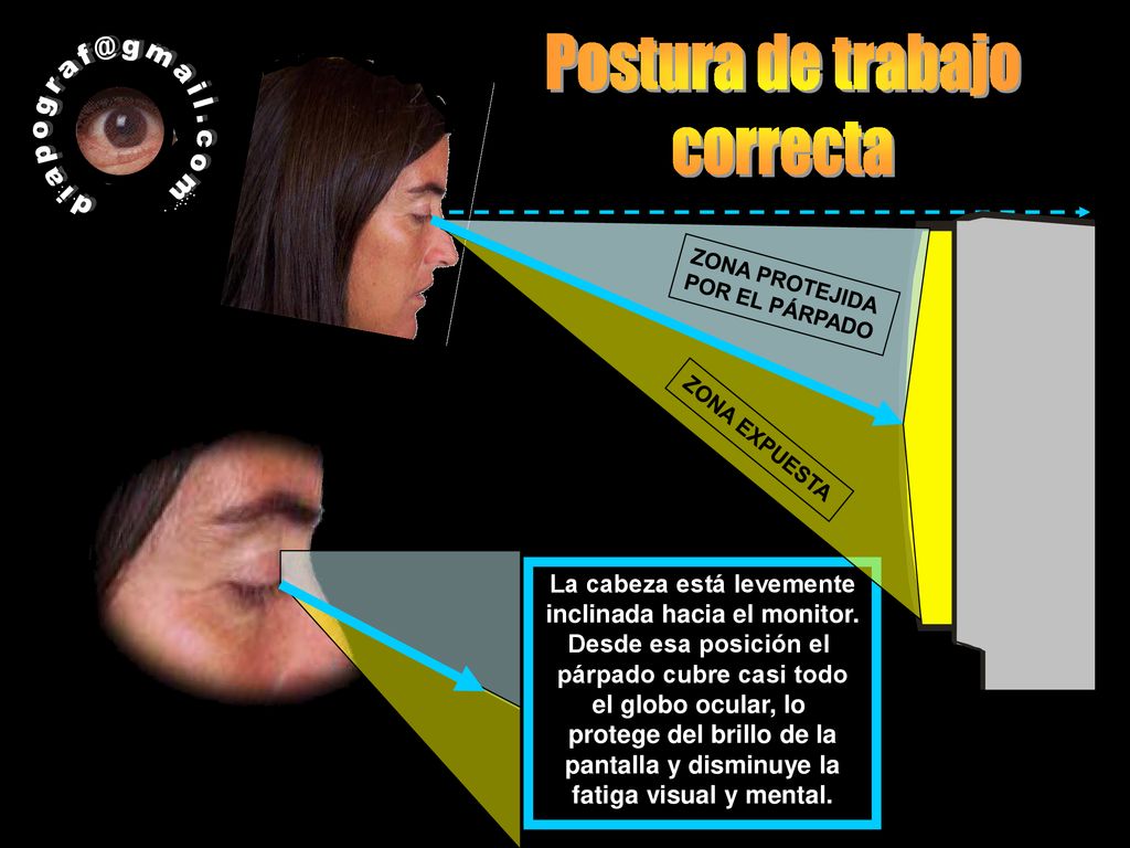 Postura de trabajo correcta La cabeza está levemente