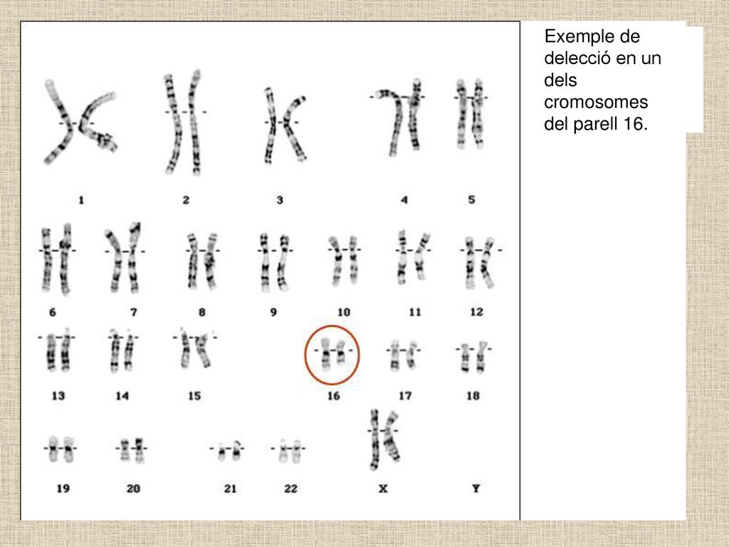Exemple de delecció en un dels cromosomes del parell 16.