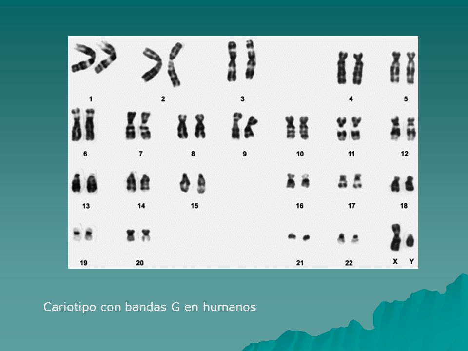 Cariotipo con bandas G en humanos