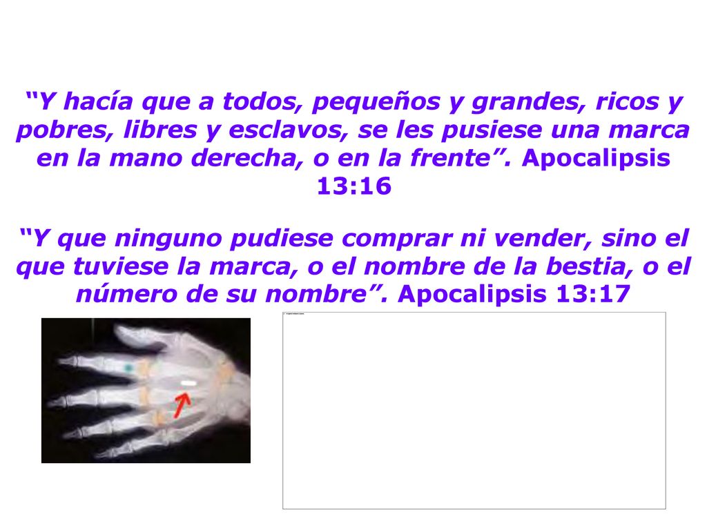 Y hacía que a todos, pequeños y grandes, ricos y pobres, libres y esclavos, se les pusiese una marca en la mano derecha, o en la frente . Apocalipsis 13:16