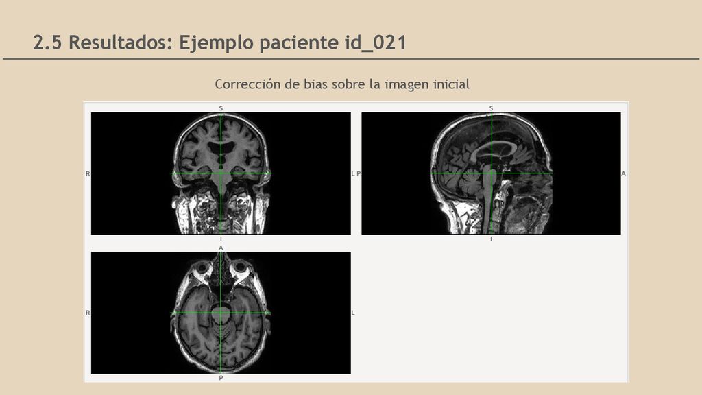 Corrección de bias sobre la imagen inicial