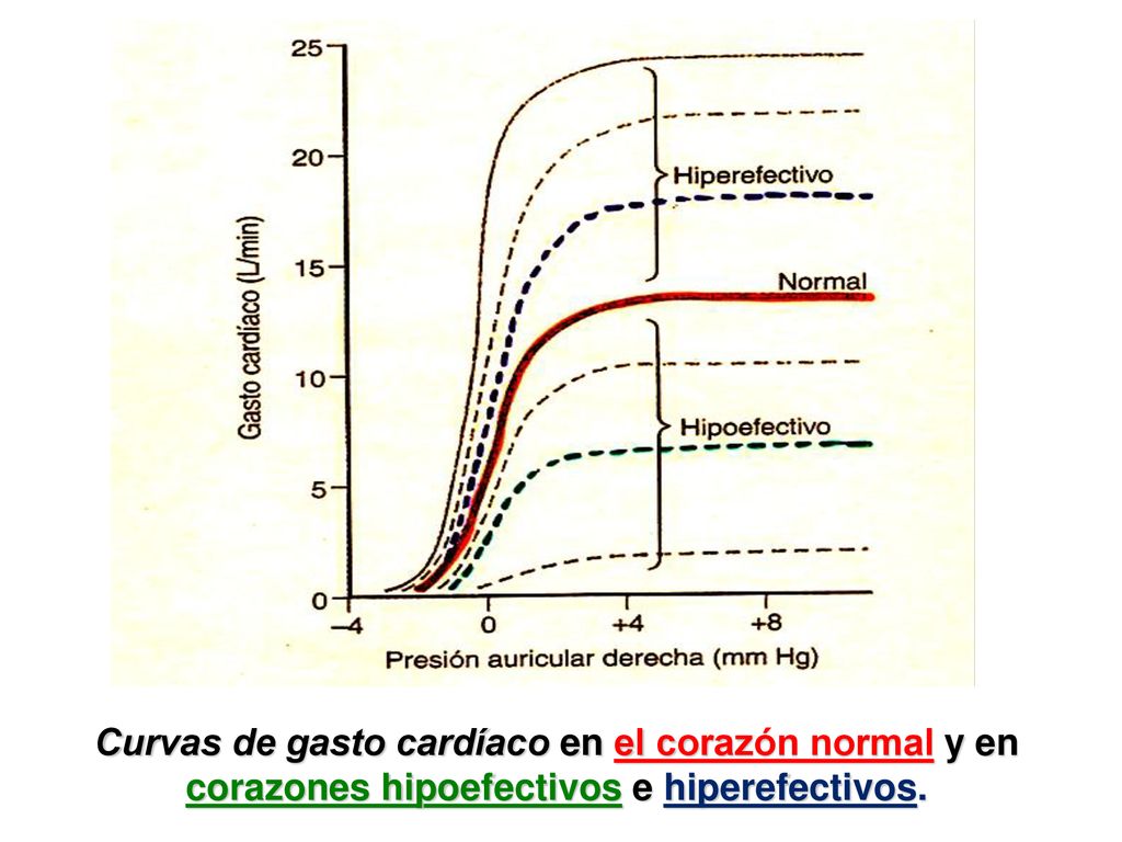 Curvas de gasto cardíaco en el corazón normal y en corazones hipoefectivos e hiperefectivos.