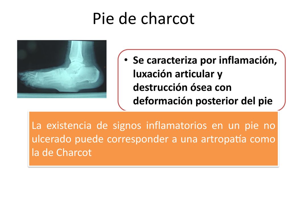 Pie de charcot Se caracteriza por inflamación, luxación articular y destrucción ósea con deformación posterior del pie.