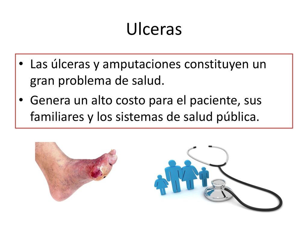 Ulceras Las úlceras y amputaciones constituyen un gran problema de salud.