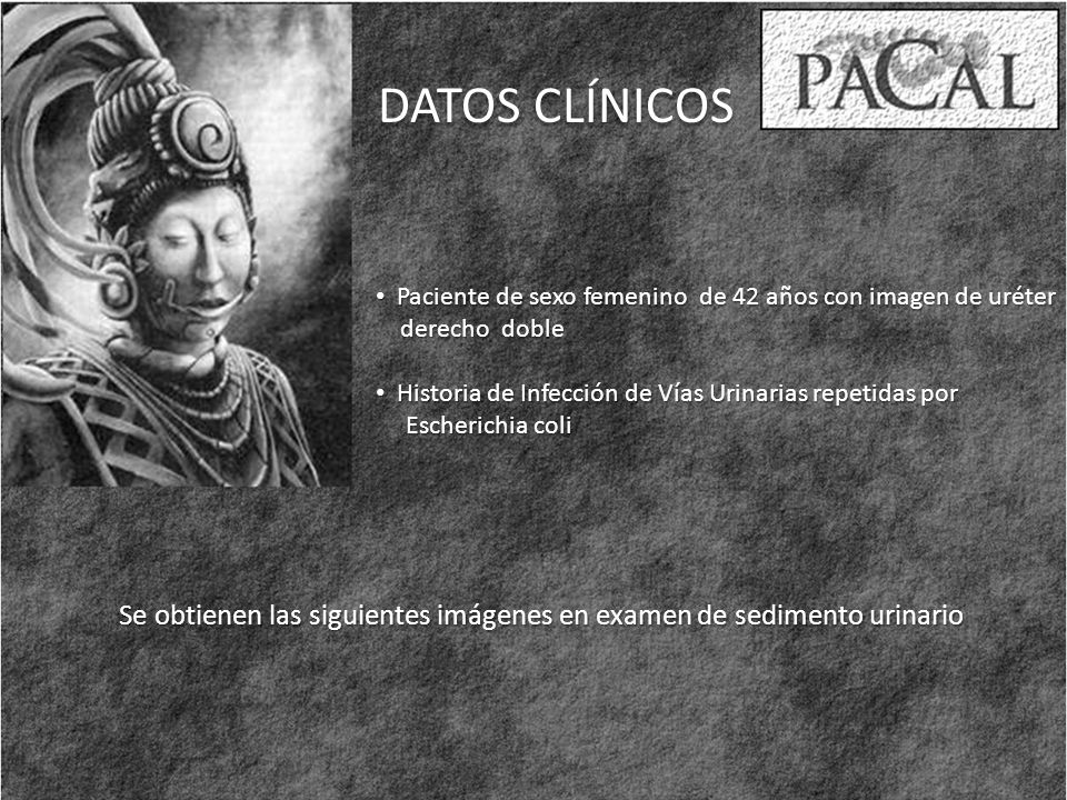 DATOS CLÍNICOS Paciente de sexo femenino de 42 años con imagen de uréter. derecho doble. Historia de Infección de Vías Urinarias repetidas por.