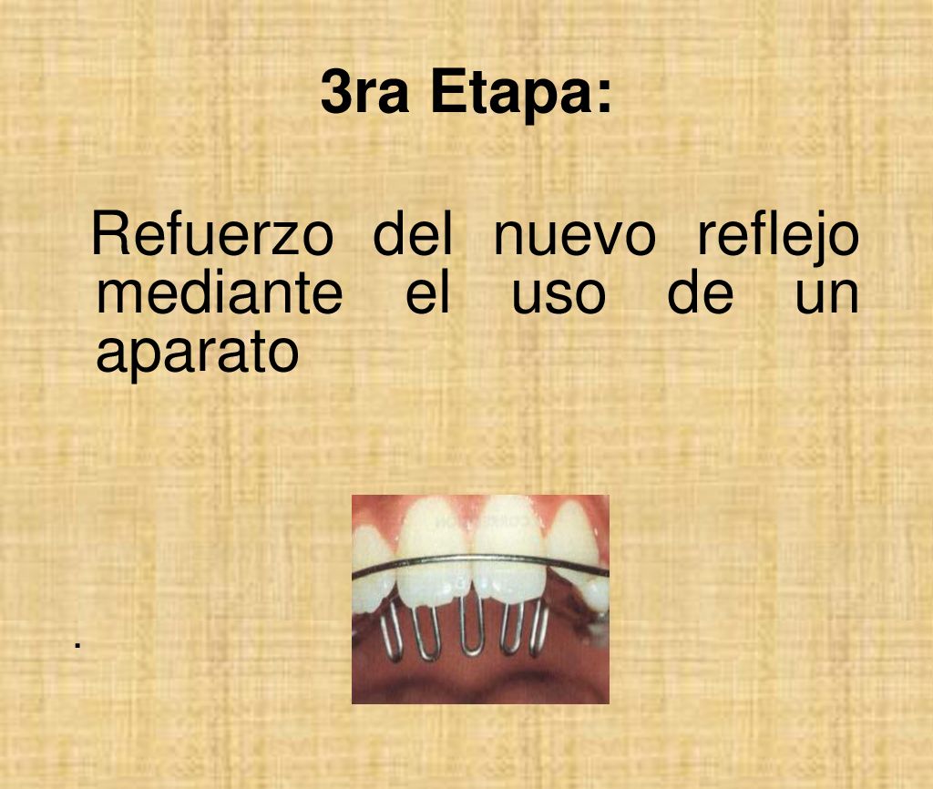 Refuerzo del nuevo reflejo mediante el uso de un aparato