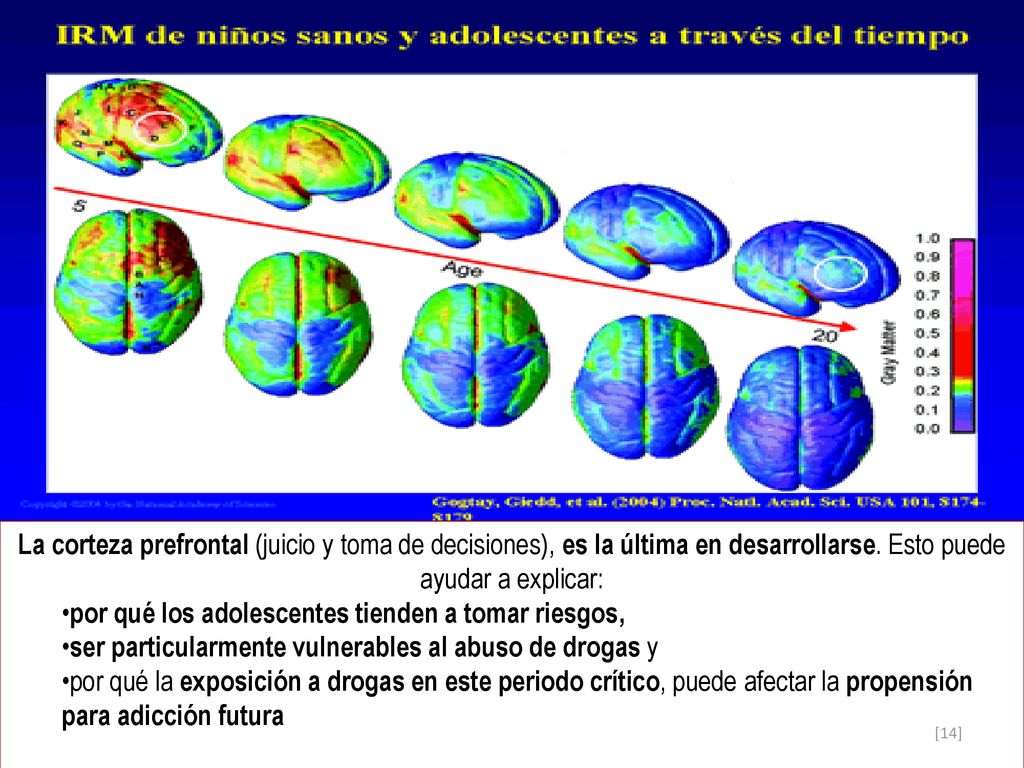 La corteza prefrontal (juicio y toma de decisiones), es la última en desarrollarse. Esto puede ayudar a explicar: