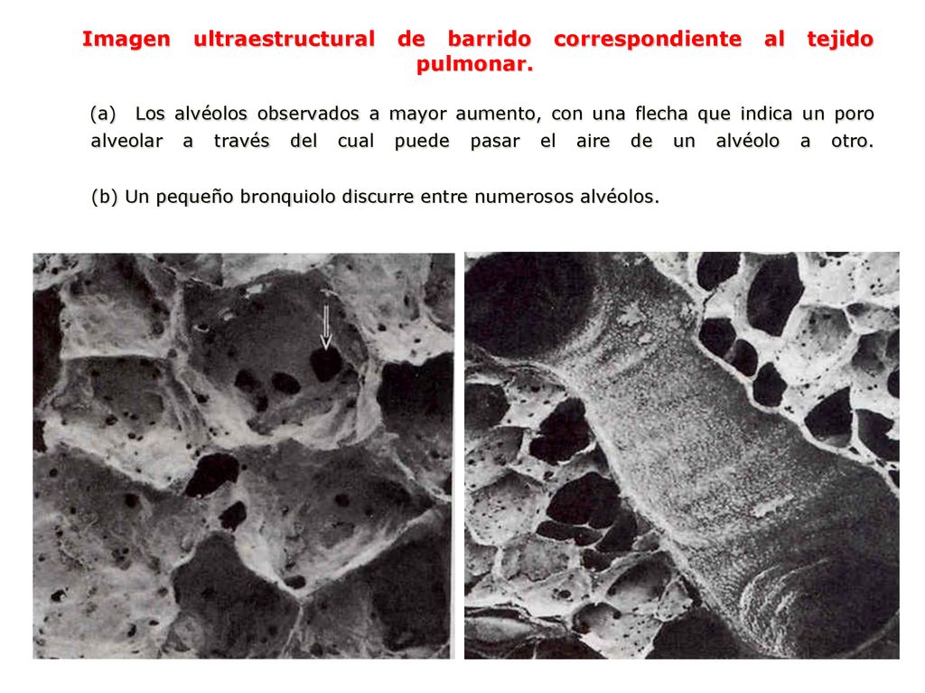 Imagen ultraestructural de barrido correspondiente al tejido pulmonar