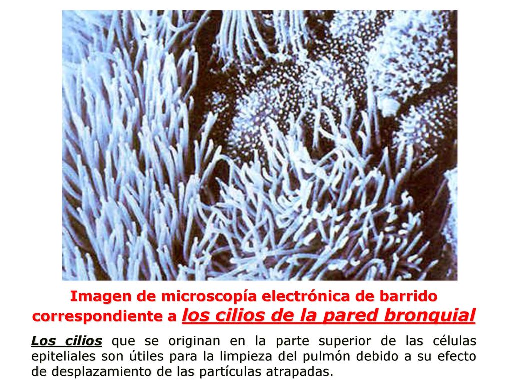 Imagen de microscopía electrónica de barrido correspondiente a los cilios de la pared bronquial