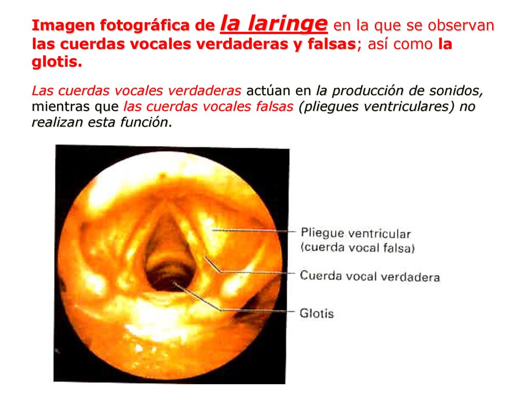Imagen fotográfica de la laringe en la que se observan las cuerdas vocales verdaderas y falsas; así como la glotis.