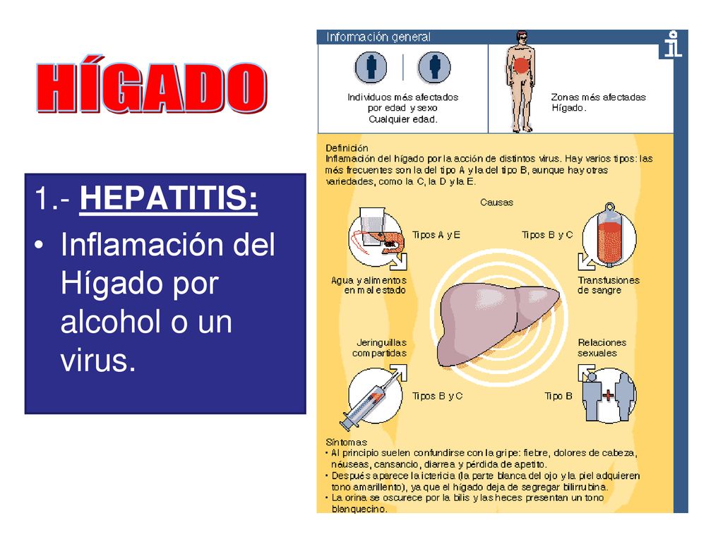 HÍGADO 1.- HEPATITIS: Inflamación del Hígado por alcohol o un virus.