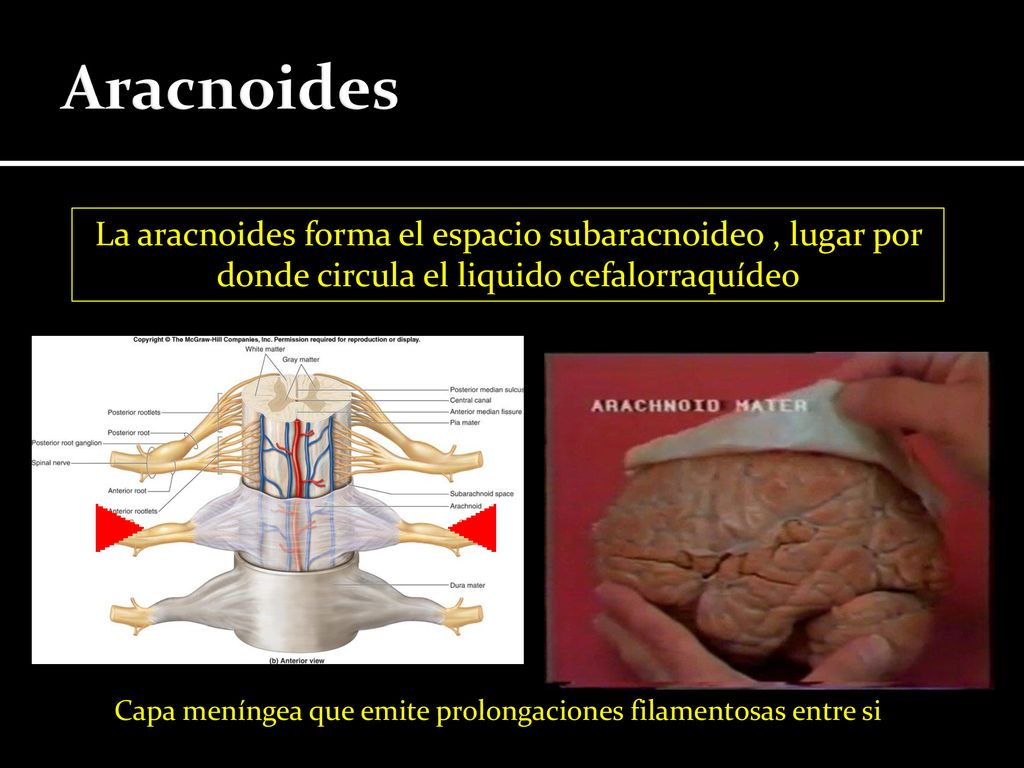 Aracnoides La aracnoides forma el espacio subaracnoideo , lugar por donde circula el liquido cefalorraquídeo.