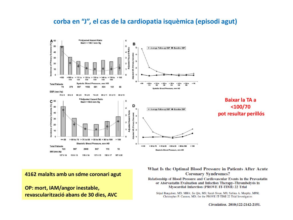 corba en J , el cas de la cardiopatia isquèmica (episodi agut)