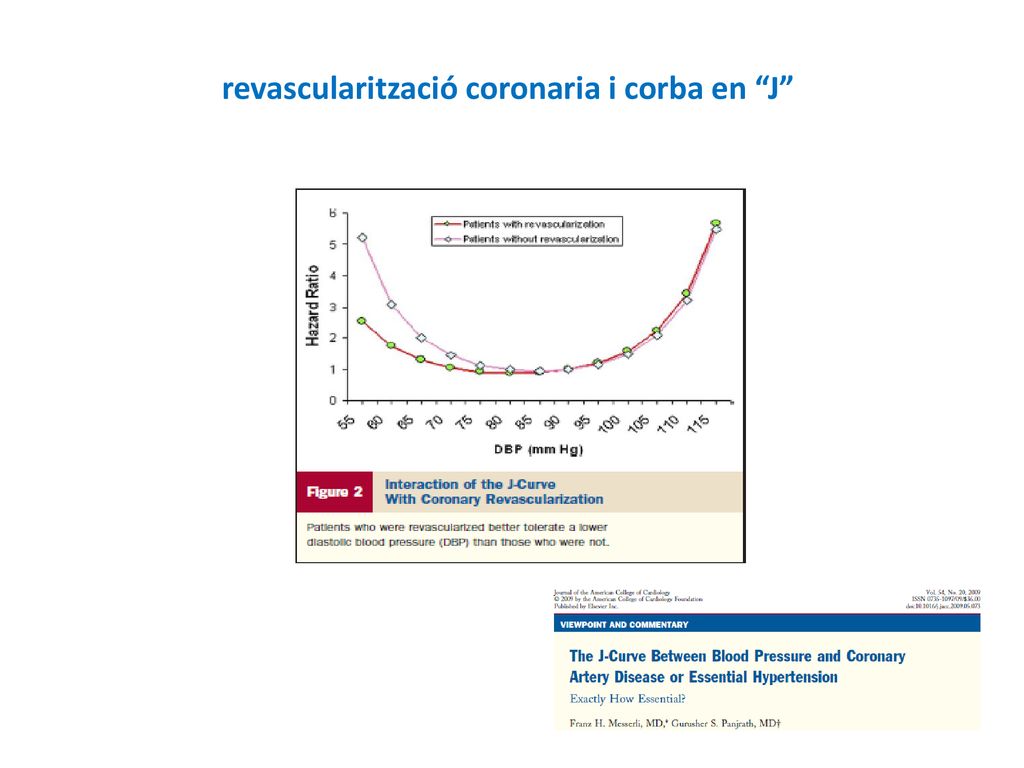 revascularització coronaria i corba en J