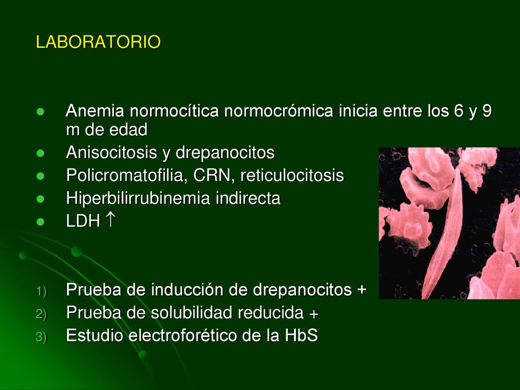 LABORATORIO Anemia normocítica normocrómica inicia entre los 6 y 9 m de edad. Anisocitosis y drepanocitos.