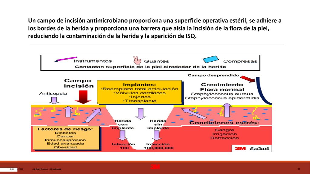 Un campo de incisión antimicrobiano proporciona una superficie operativa estéril, se adhiere a los bordes de la herida y proporciona una barrera que aísla la incisión de la flora de la piel, reduciendo la contaminación de la herida y la aparición de ISQ.