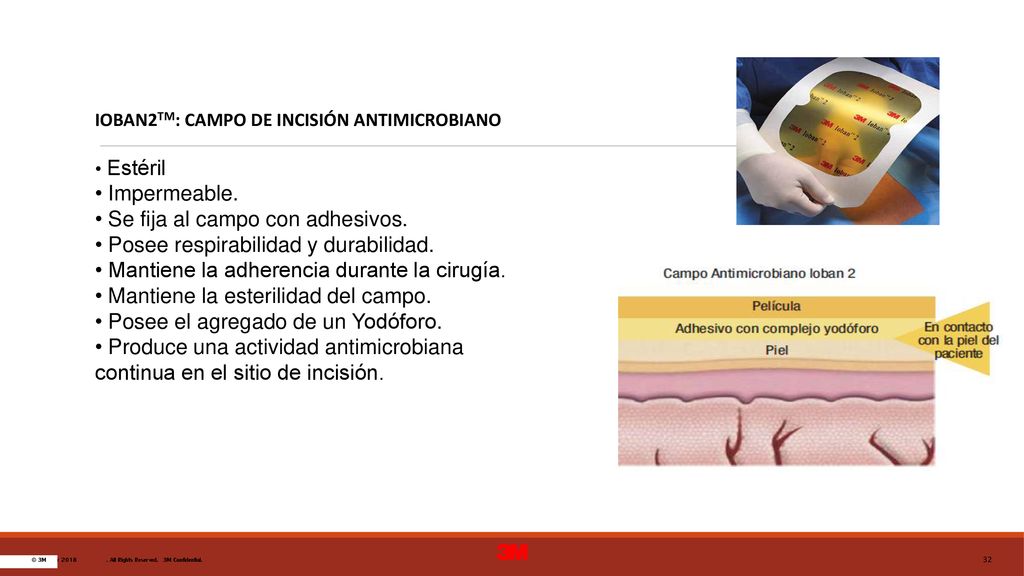 Se fija al campo con adhesivos. Posee respirabilidad y durabilidad.
